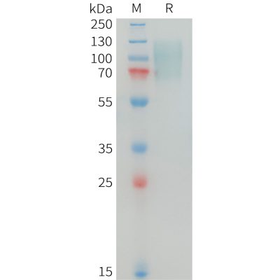 sp-PME100344 MERTK Fig.1 SDS PAGE 1