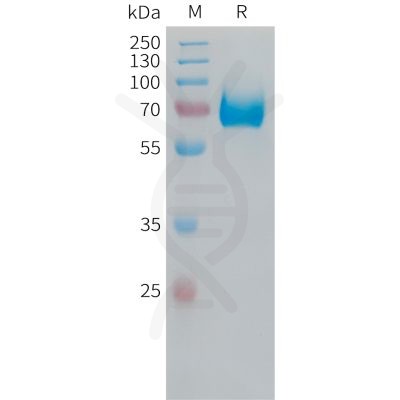 sp-PME100530 CD38 Fig.1 SDS PAGE 1