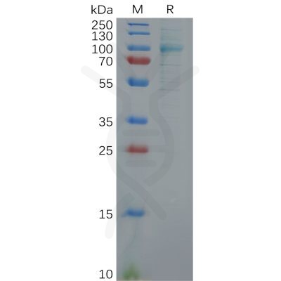 sp-PME100626 FAP Fig.1 SDS PAGE 1