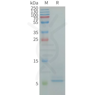 sp-PME100849 CD9 Fig.1 SDS PAGE 1