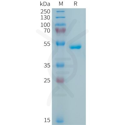 sp-PME100854 APRIL Fig.1 SDS PAGE 1