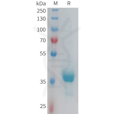 sp-PME100933 CX3CR1 Fig.1 SDS PAGE 1