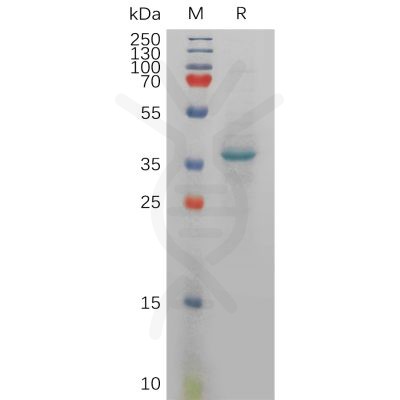 sp-PME100935 CXCL12 Fig.1 SDS PAGE 1