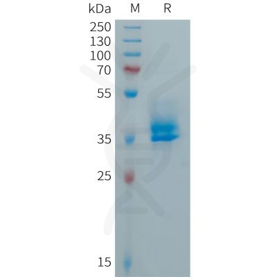 sp-PME101036 CALCA Fig.1 SDS PAGE 1