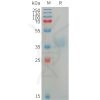 sp-PME101225 AZU1 Fig.1 SDS PAGE 1