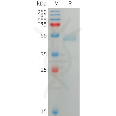 sp-PME101226 ANGPTL7 Fig.1 SDS PAGE 1