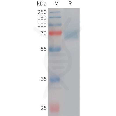 sp-PME101227 ACHE Fig.1 SDS PAGE 1