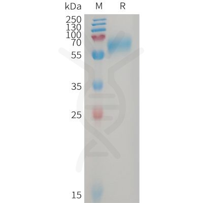 sp-PME101228 GPR56 Fig.1 SDS PAGE 1