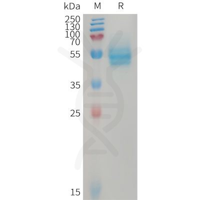 sp-PME101229 CD14 Fig.1 SDS PAGE 1