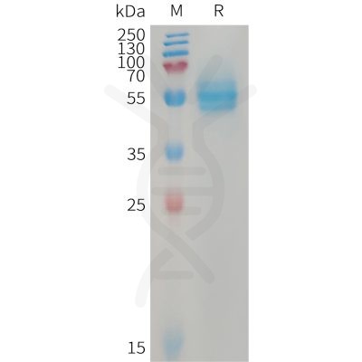 sp-PME101230 CD14 Fig.1 SDS PAGE 1