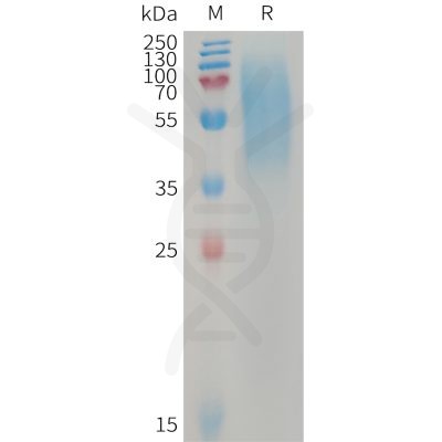 sp-PME101231 LYPD3 Fig.1 SDS PAGE 1