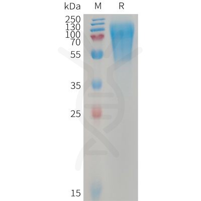 sp-PME101232 LYPD3 Fig.1 SDS PAGE 1