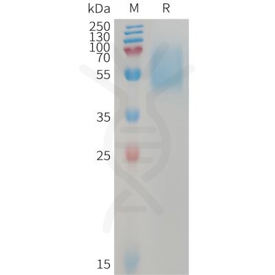 sp-PME101233 ACVR1C Fig.1 SDS PAGE 1