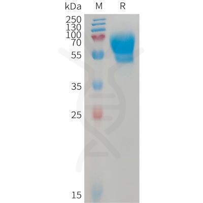 sp-PME101234 ACVRL1 Fig.1 SDS PAGE 1