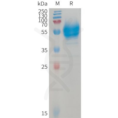 sp-PME101235 BTC Fig.1 SDS PAGE 1