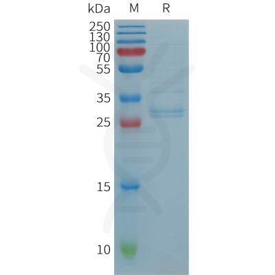 sp-PME101236 CCL19 Fig.1 SDS PAGE 1