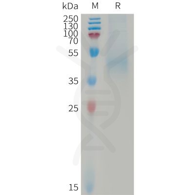 sp-PME101239 DKK1 Fig.1 SDS PAGE 1