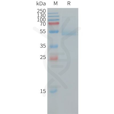 sp-PME101243 RHOB Fig.1 SDS PAGE 1