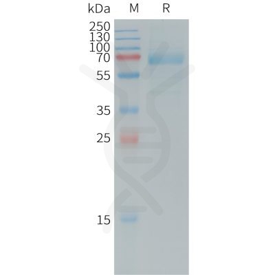 sp-PME101245 DKK1 Fig.1 SDS PAGE 1