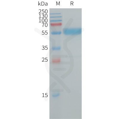 sp-PME101250 IL19 Fig.1 SDS PAGE 1