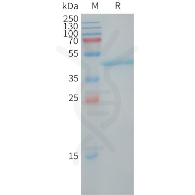 sp-PME101251 LY6H Fig.1 SDS PAGE 1