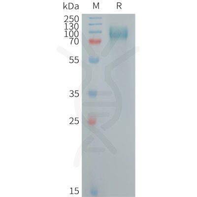 sp-PME101255 GPNMB Fig.1 SDS PAGE 1