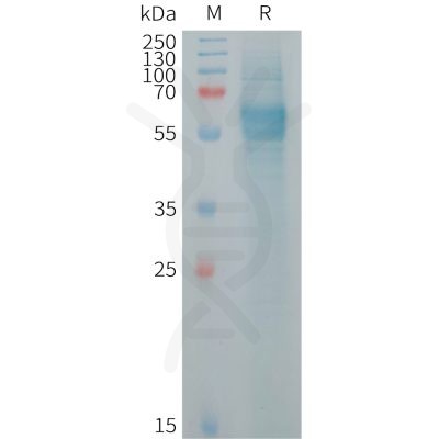 sp-PME101256 FCRL2 Fig.1 SDS PAGE 1