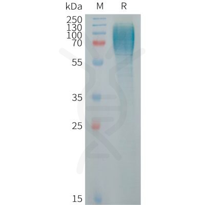 sp-PME101257 ICAM3 Fig.1 SDS PAGE 1