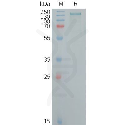 sp-PME101259 CD109 Fig.1 SDS PAGE 1