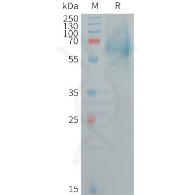 sp-PME101260 IGHE Fig.1 SDS PAGE 1