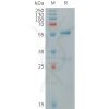 sp-PME101262 CLEC4A Fig.1 SDS PAGE 1