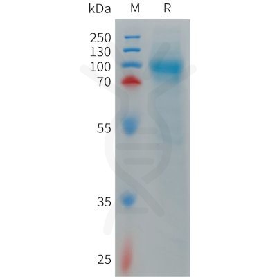 sp-PME101263 LRRN1 Fig.1 SDS PAGE 1