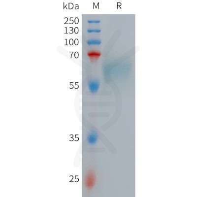 sp-PME101264 LRP10 Fig.1 SDS PAGE 1