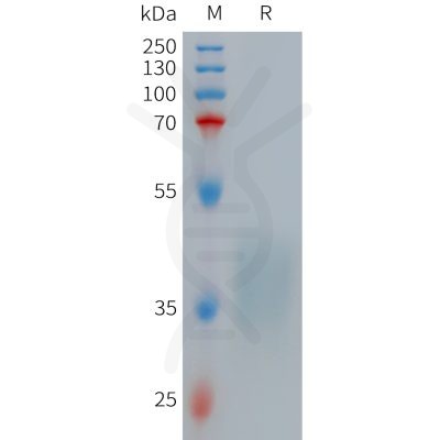 sp-PME101265 TNFRSF1B Fig.1 SDS PAGE 1