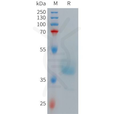 sp-PME101268 GRPR Fig.1 SDS PAGE 1