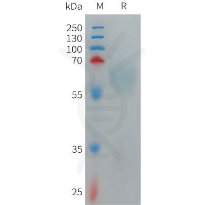 sp-PME101270 TMEM219 Fig.1 SDS PAGE 1