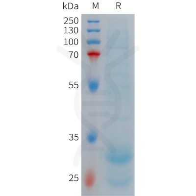 sp-PME101272 HAMP Fig.1 SDS PAGE 1