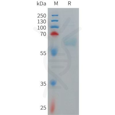 sp-PME101274 PILRA Fig.1 SDS PAGE 1