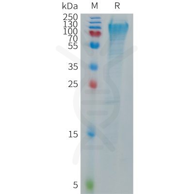 sp-PME101275 MANSC1 Fig.1 SDS PAGE 1