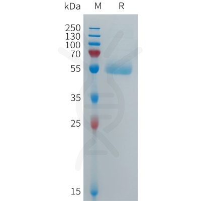 sp-PME101276 CPM Fig.1 SDS PAGE 1