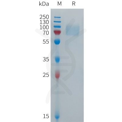 sp-PME101278 FCGR3B Fig.1 SDS PAGE 1