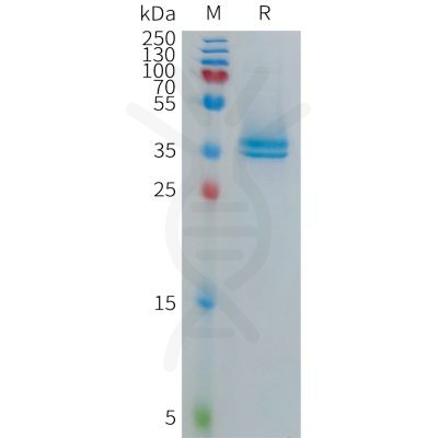 sp-PME101279 TAFA5 Fig.1 SDS PAGE 1