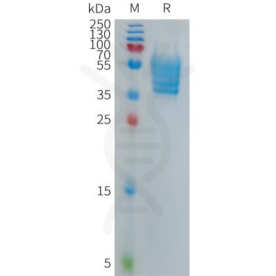 sp-PME101280 ECSCR Fig.1 SDS PAGE 1