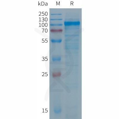 sp-PME101284 PTGFRN Fig.1 SDS PAGE 1