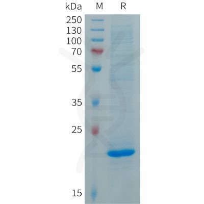 sp-PME101285 FGF19 Fig.1 SDS PAGE 1