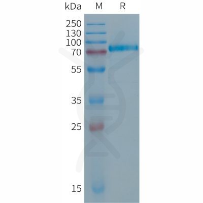 sp-PME101286 DSG2 Fig.1 SDS PAGE 1