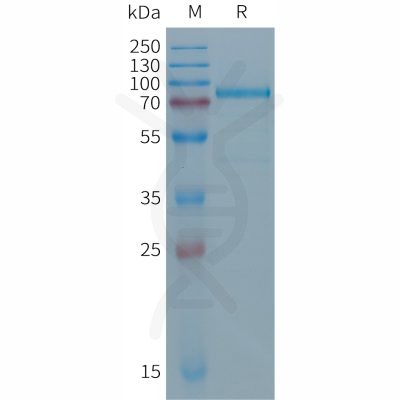 sp-PME101287 DSG2 Fig.1 SDS PAGE 1