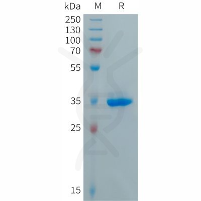 sp-PME101288 CXCL5 Fig.1 SDS PAGE 1