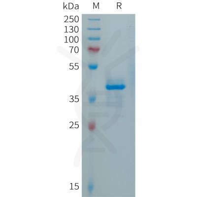 sp-PME101289 CALCA Fig.1 SDS PAGE 1