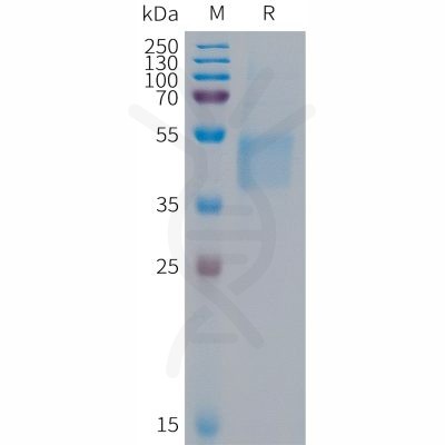 sp-PME101291 FSTL1 Fig.1 SDS PAGE 1